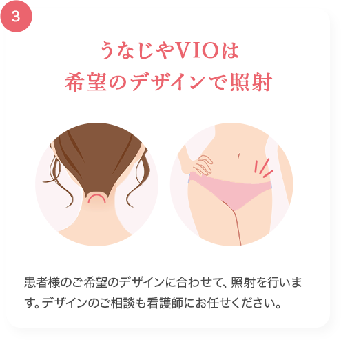 うなじやVIOは希望のデザインで照射